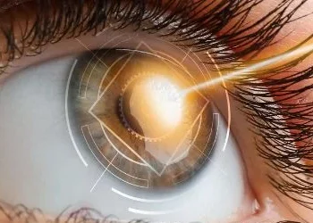 Servicios cirugia refractiva img1